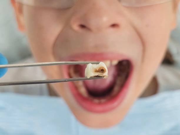 Best Emergency Treatment for Toothache in Sanatoga, PA